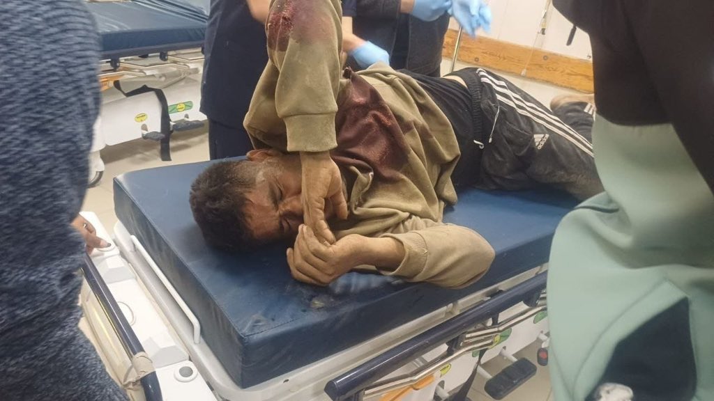 Palestinian boy wounded by Israeli fire near Khan Younis