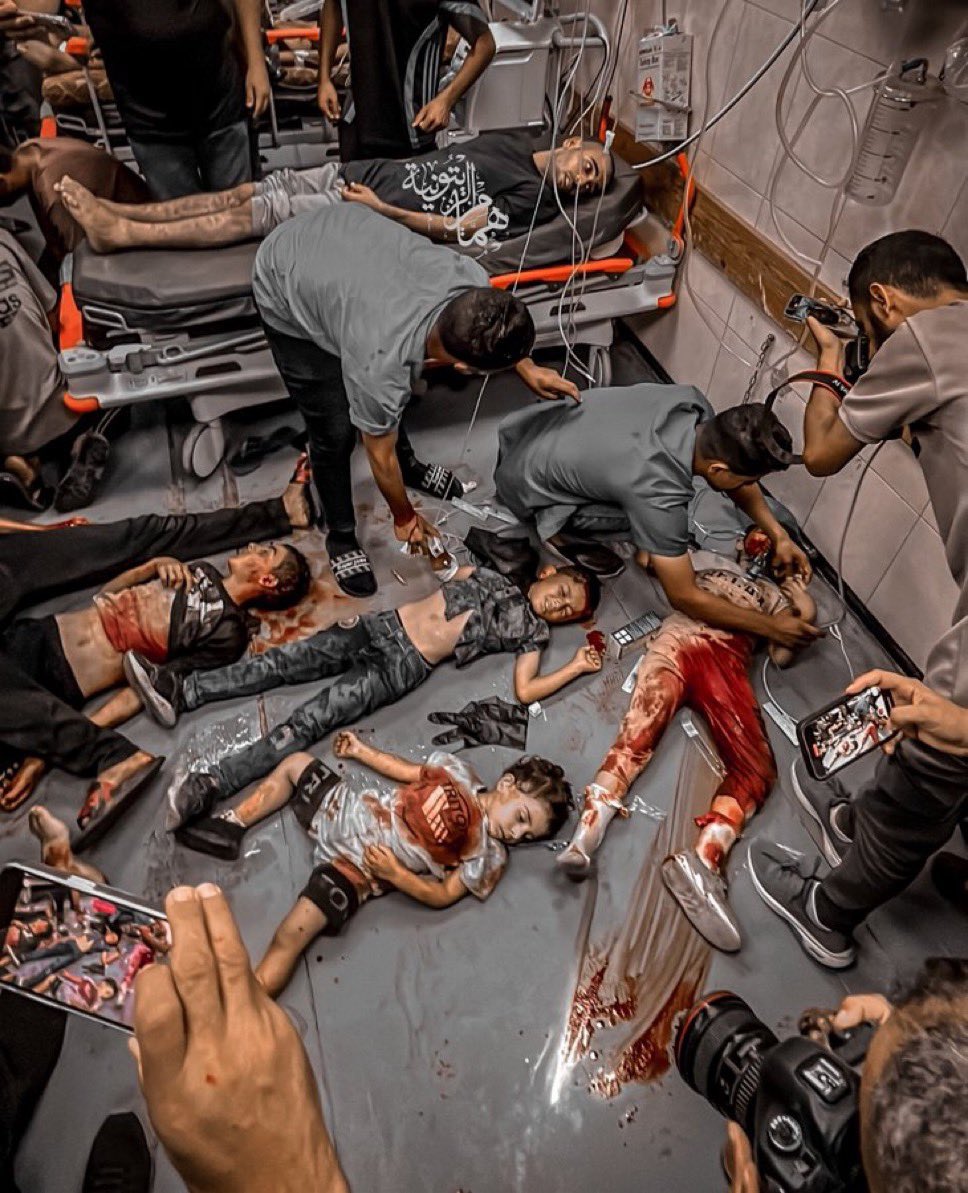 Children Wounded in Israeli Bombing of Displaced Persons Tents