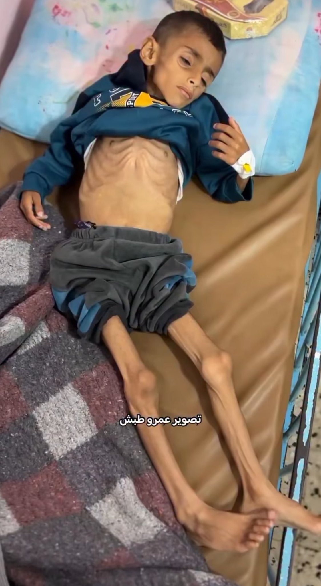 Famine crisis devastating Gaza’s children under blockade