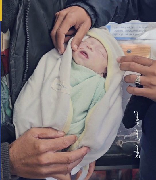 Infant Death in Al Mawasi Gaza Tent Camp