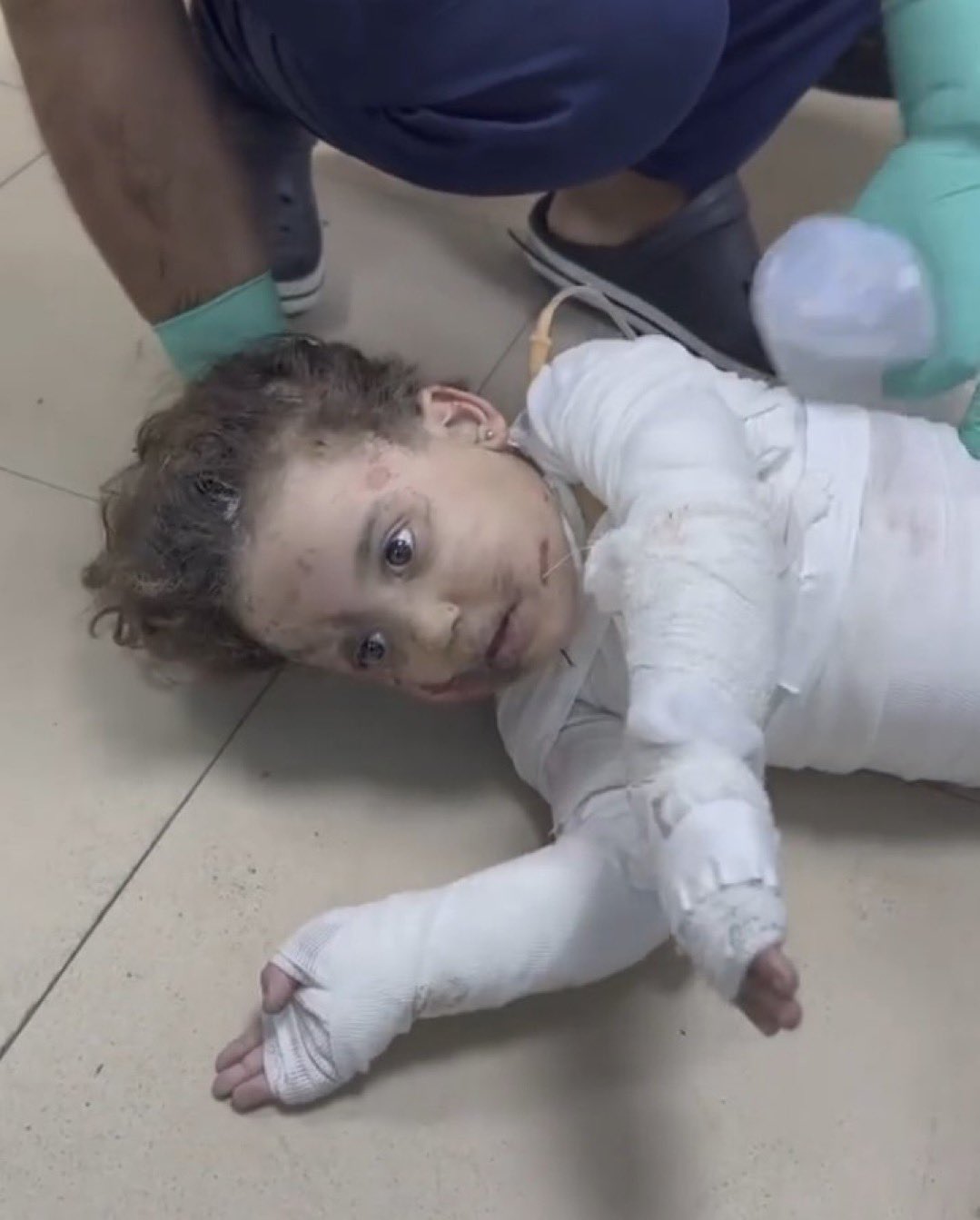 Hospital Crisis in Jabalia Under Israeli Bombing