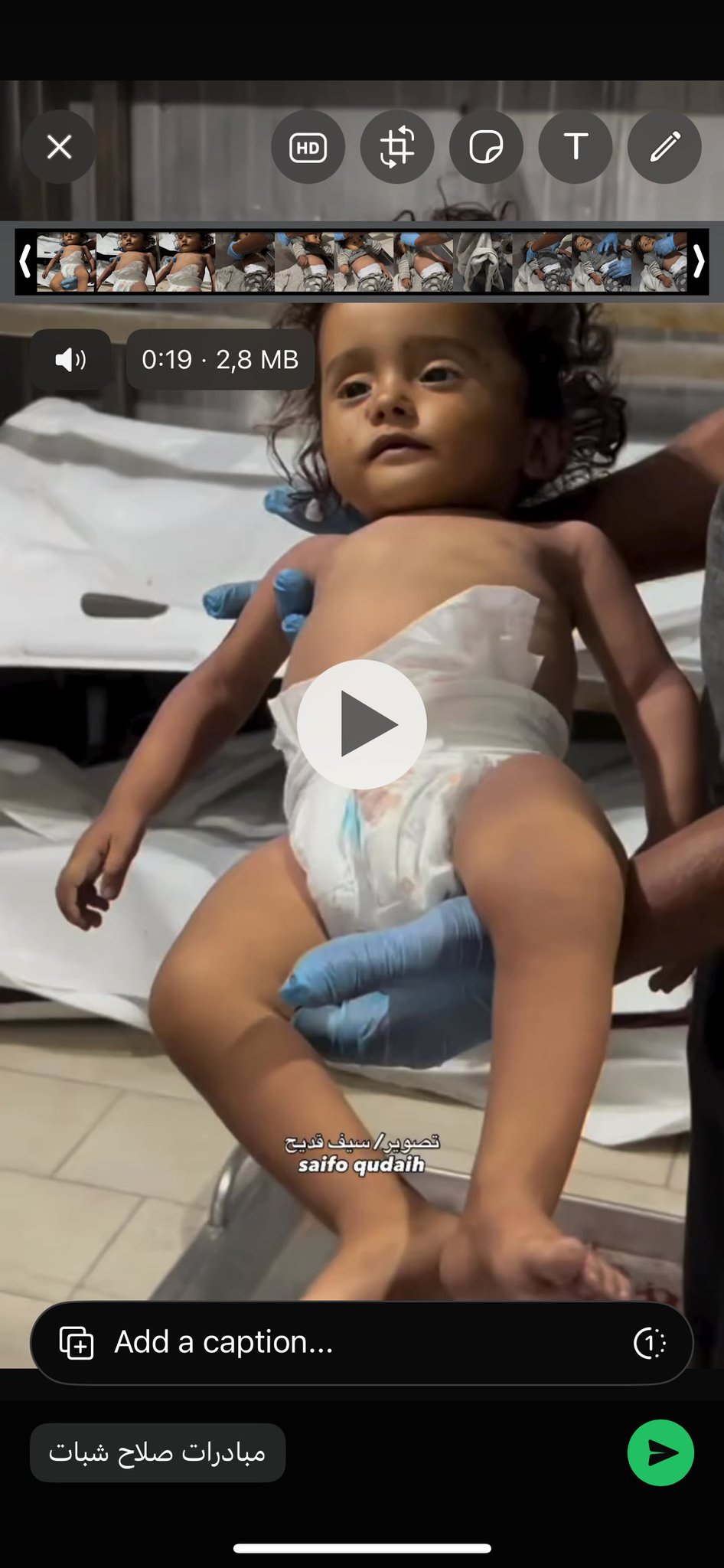 Infant death from malnutrition in Gaza amid Israeli blockade