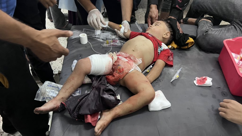 Hospital Surgery Without Anaesthesia Gaza Crisis