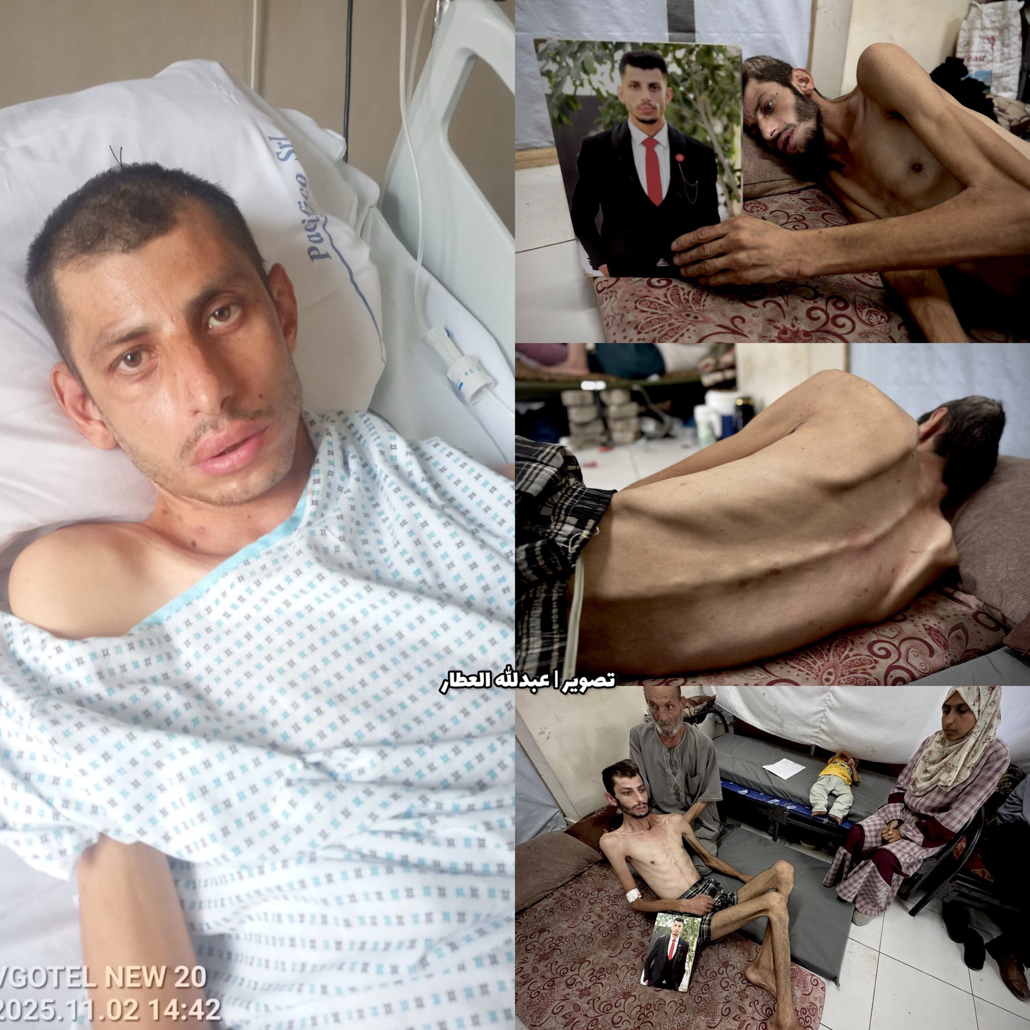 Palestinian Casualty Recovery: Medical Evacuation Success Story
