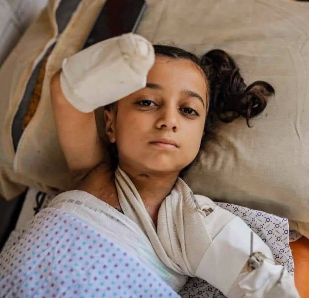 Girl loses limbs in Israeli conflict, yearns for normalcy