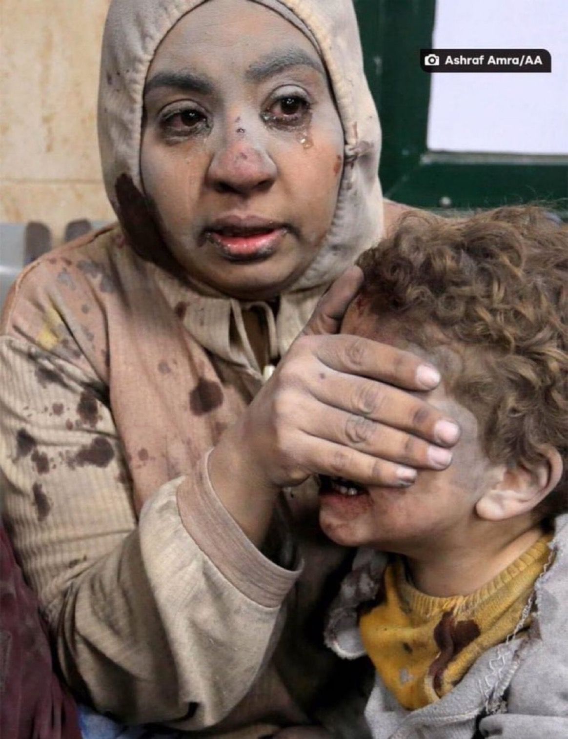 Palestinian Mother Shields Son During Medical Care in Gaza