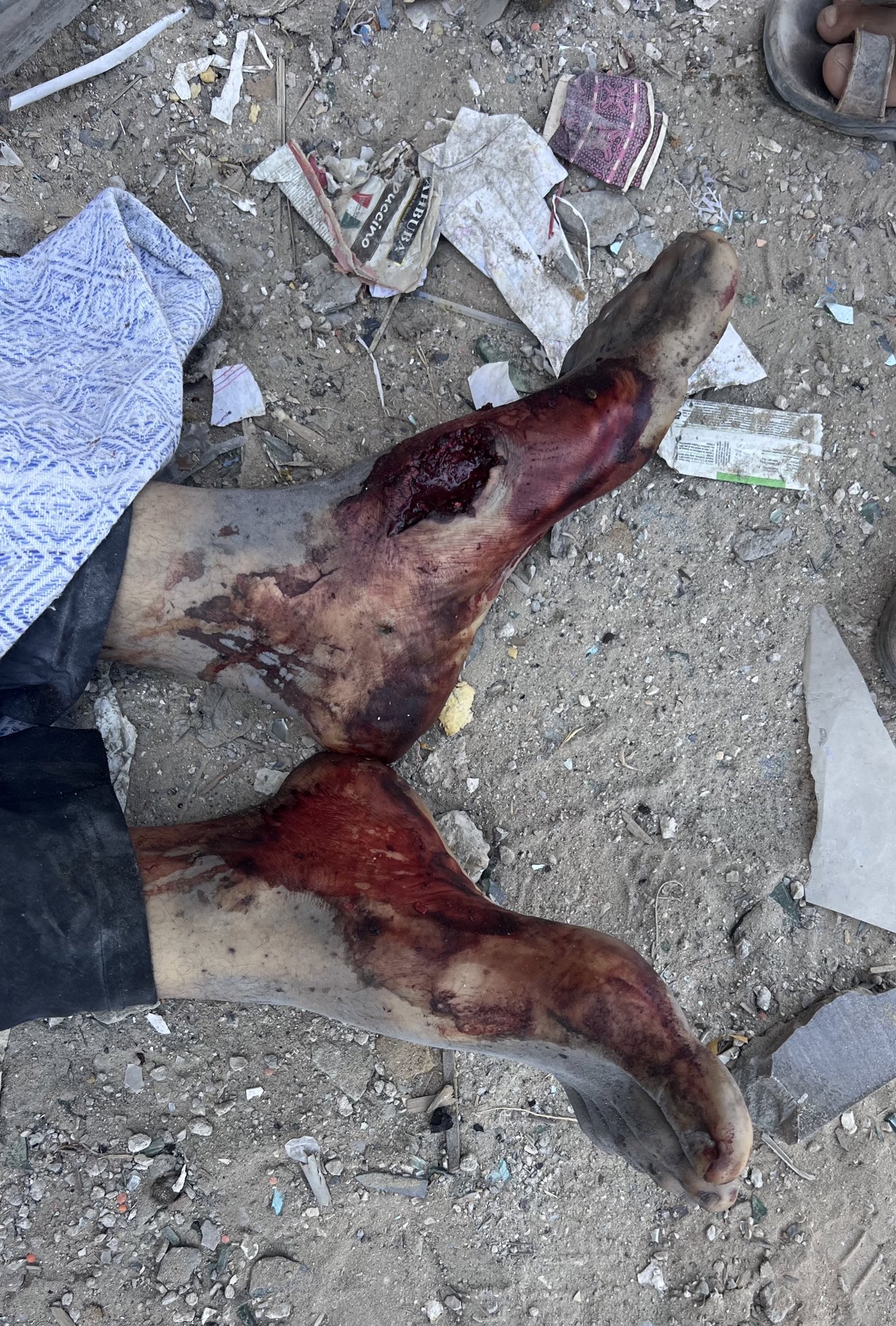 Israeli airstrikes kill civilians in Gaza neighborhoods