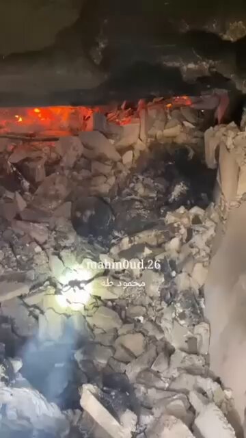 Civil Defense Rescues Severely Burned Man from Gaza Building Rubble