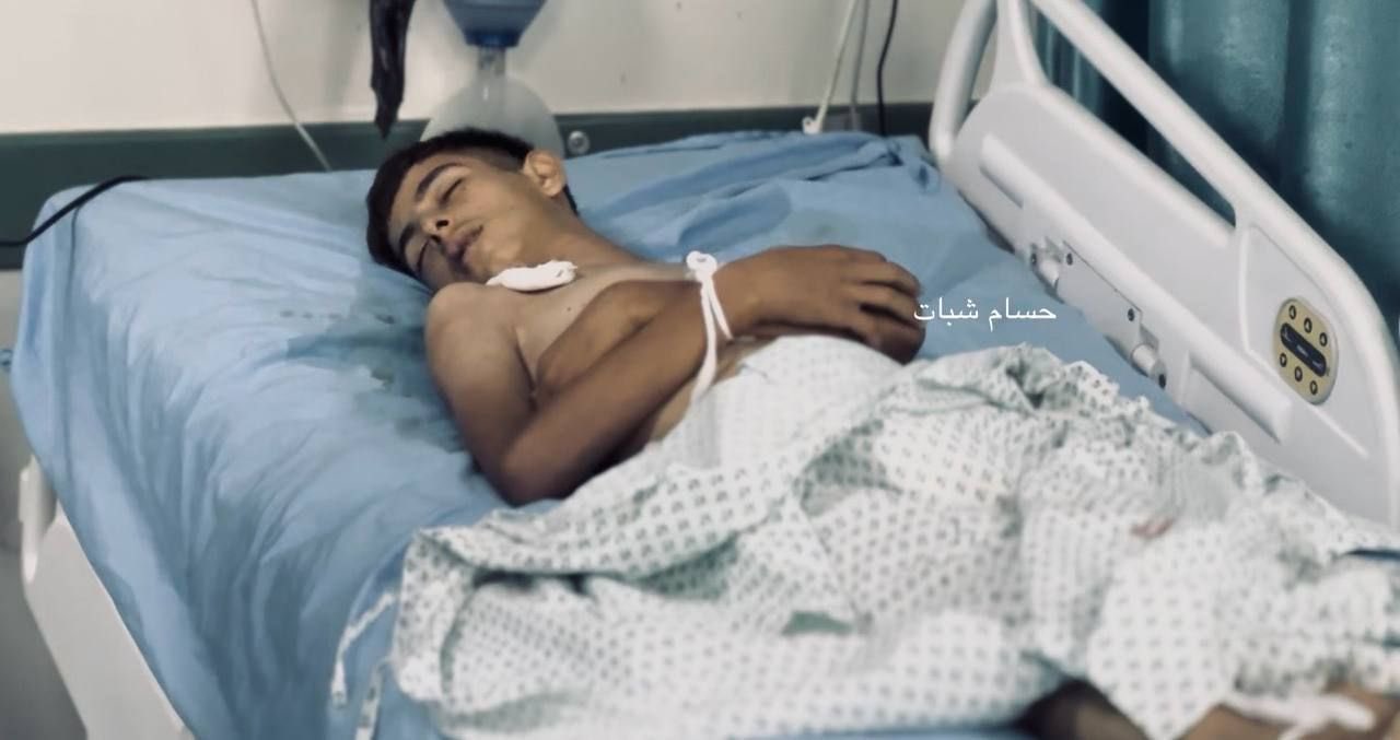 Palestinian Teen Dies from Malnutrition in Gaza Hospital