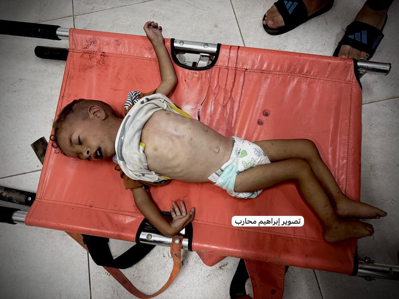UNICEF Deputy Director on Gaza Famine and Child Malnutrition Crisis