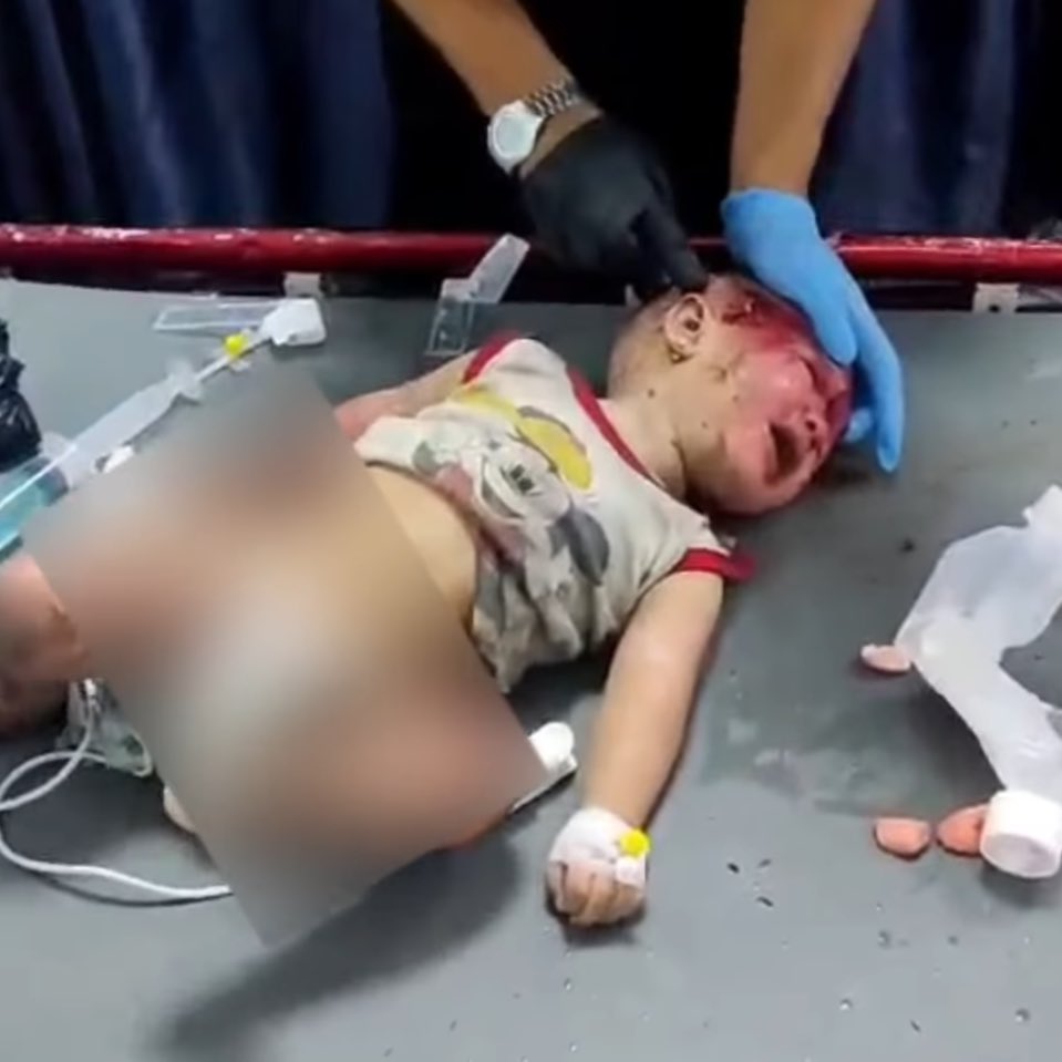 Four-month-old baby rescued from rubble and hospitalized