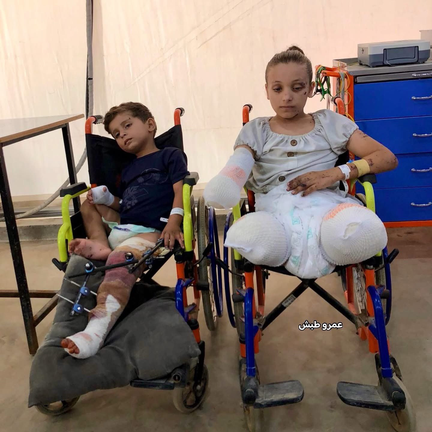 10-Year-Old Girl Lost Limbs in Israeli Strike in Gaza