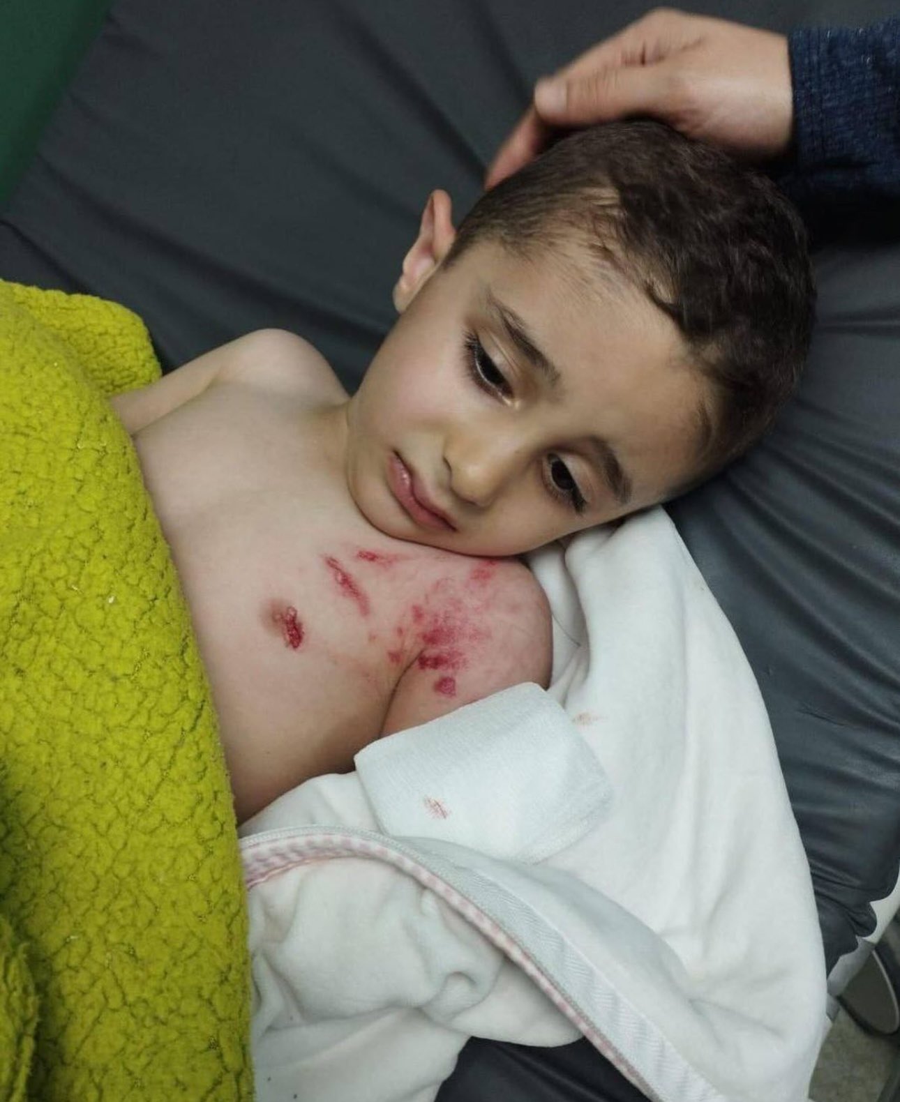 Child Injured in Israeli Forces Dog Attack in Qabatia