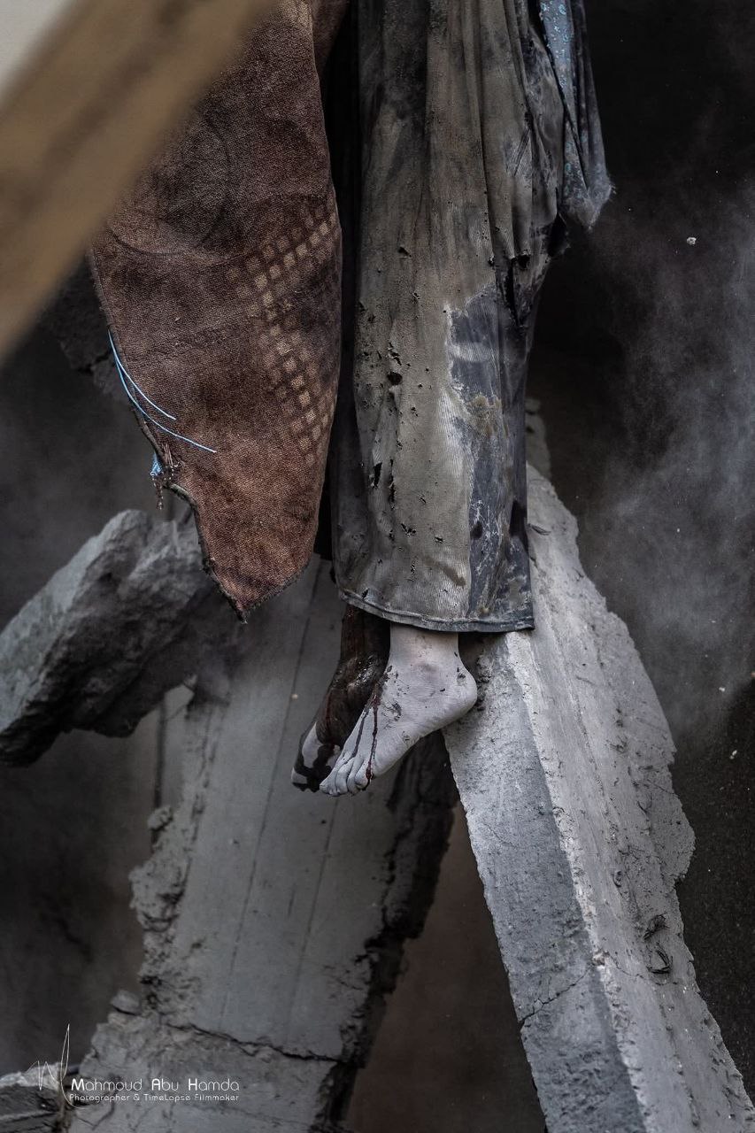 Child trapped under rubble in Gaza bombing aftermath