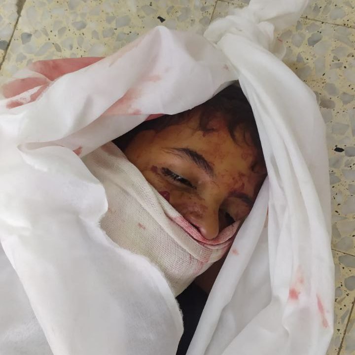 Israeli airstrike on Nuseirat school kills family, injures two children