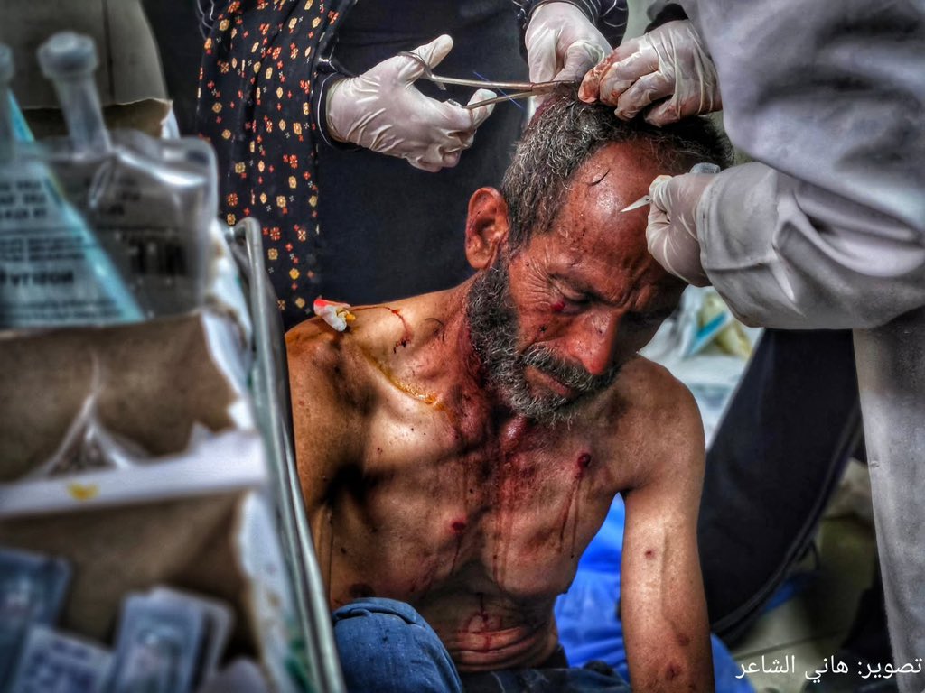 Civilian casualty in Gaza amid food scarcity
