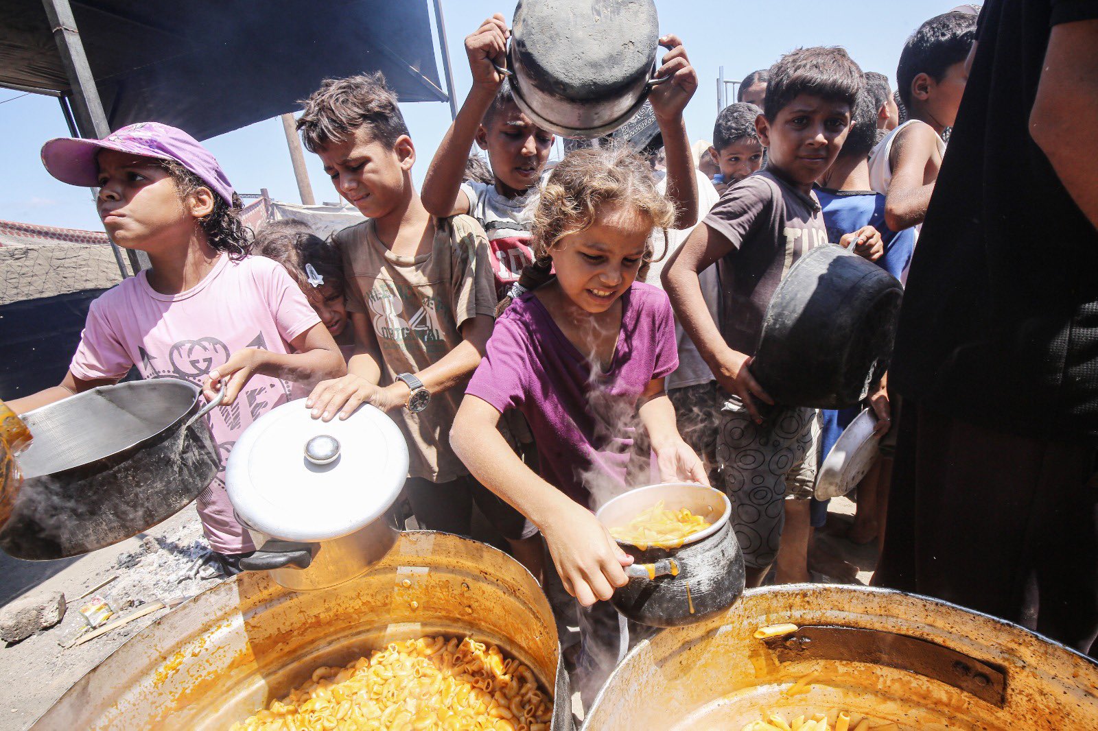 UN agencies report severe malnutrition and starvation in Gaza