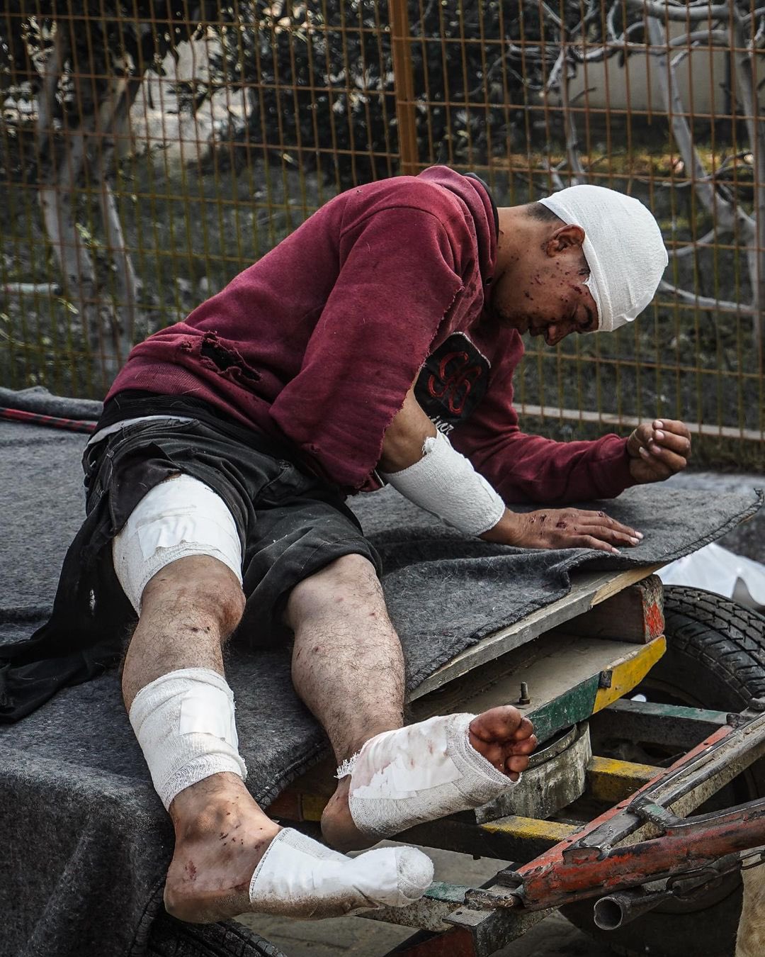 Child injured fleeing Khan Yunis to Rafah