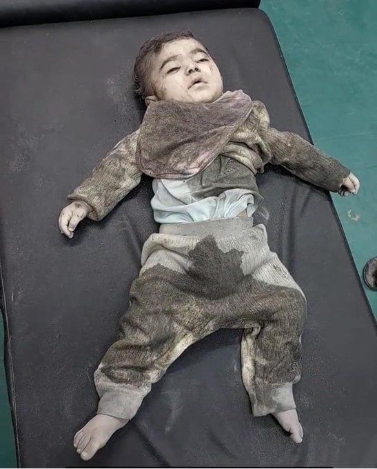 Baby born by C-section loses parents and dies in Gaza war