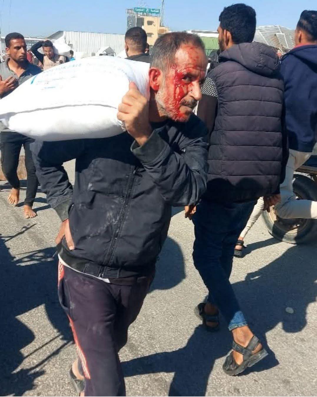 Gaza Food Crisis: Desperate Struggle for Survival in Conflict