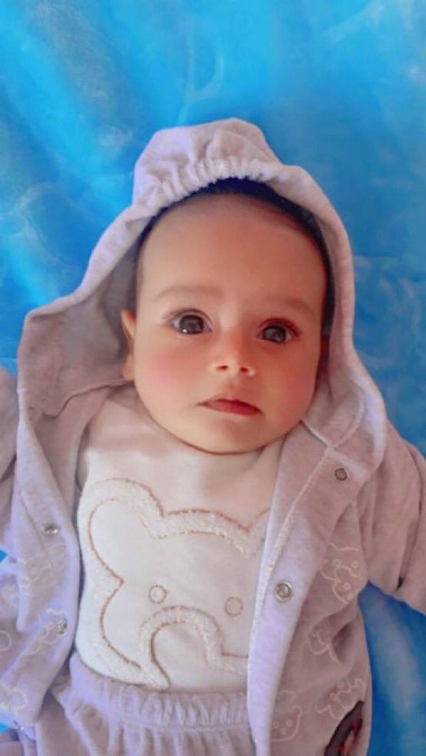 Infant Dies From Hunger During Conflict Siege