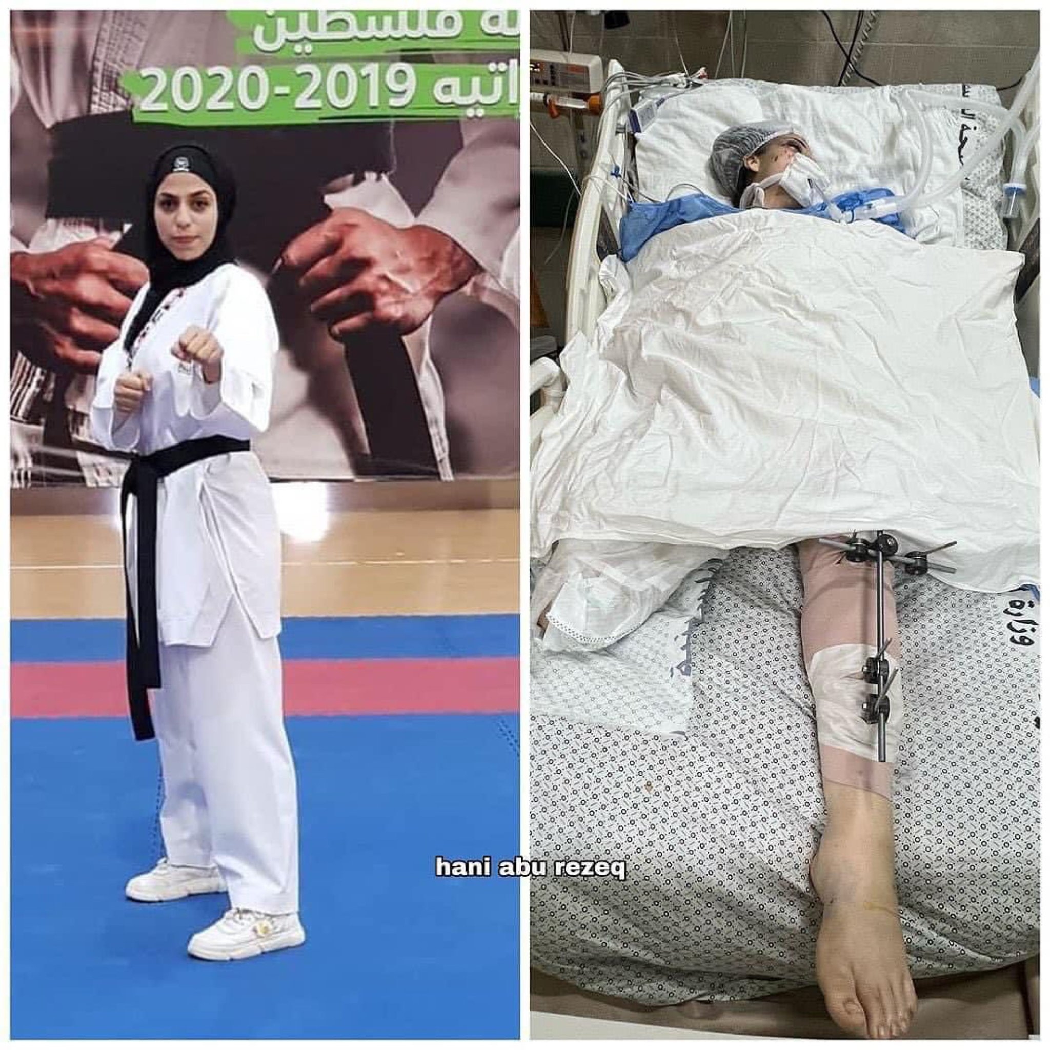 Karate player Nagham Abu Samra killed after amputation in Gaza