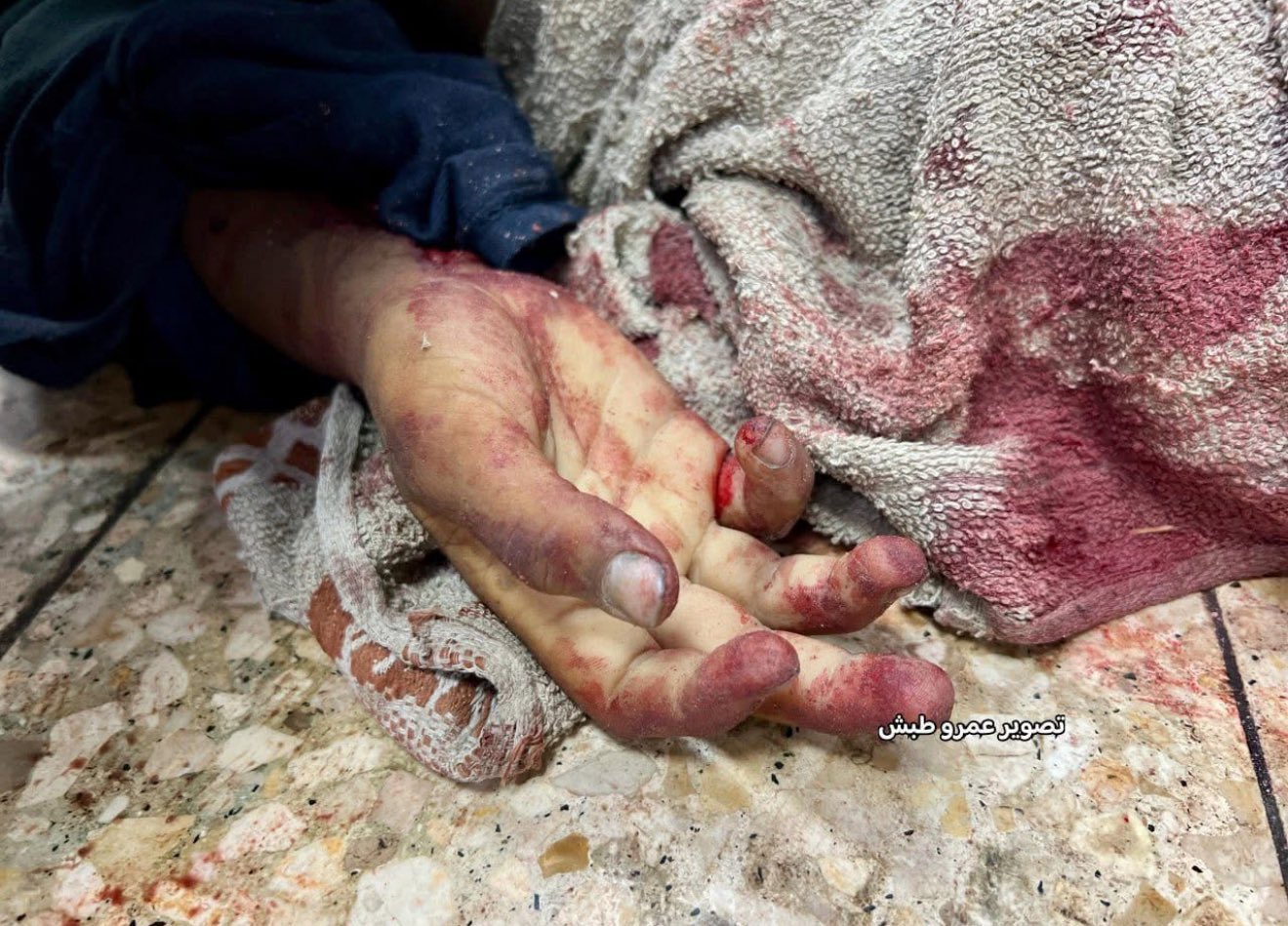Israeli bombing kills women and injures children in Nuseirat