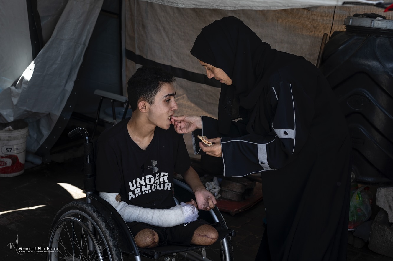 Teen loses twin and limbs in Gaza airstrike