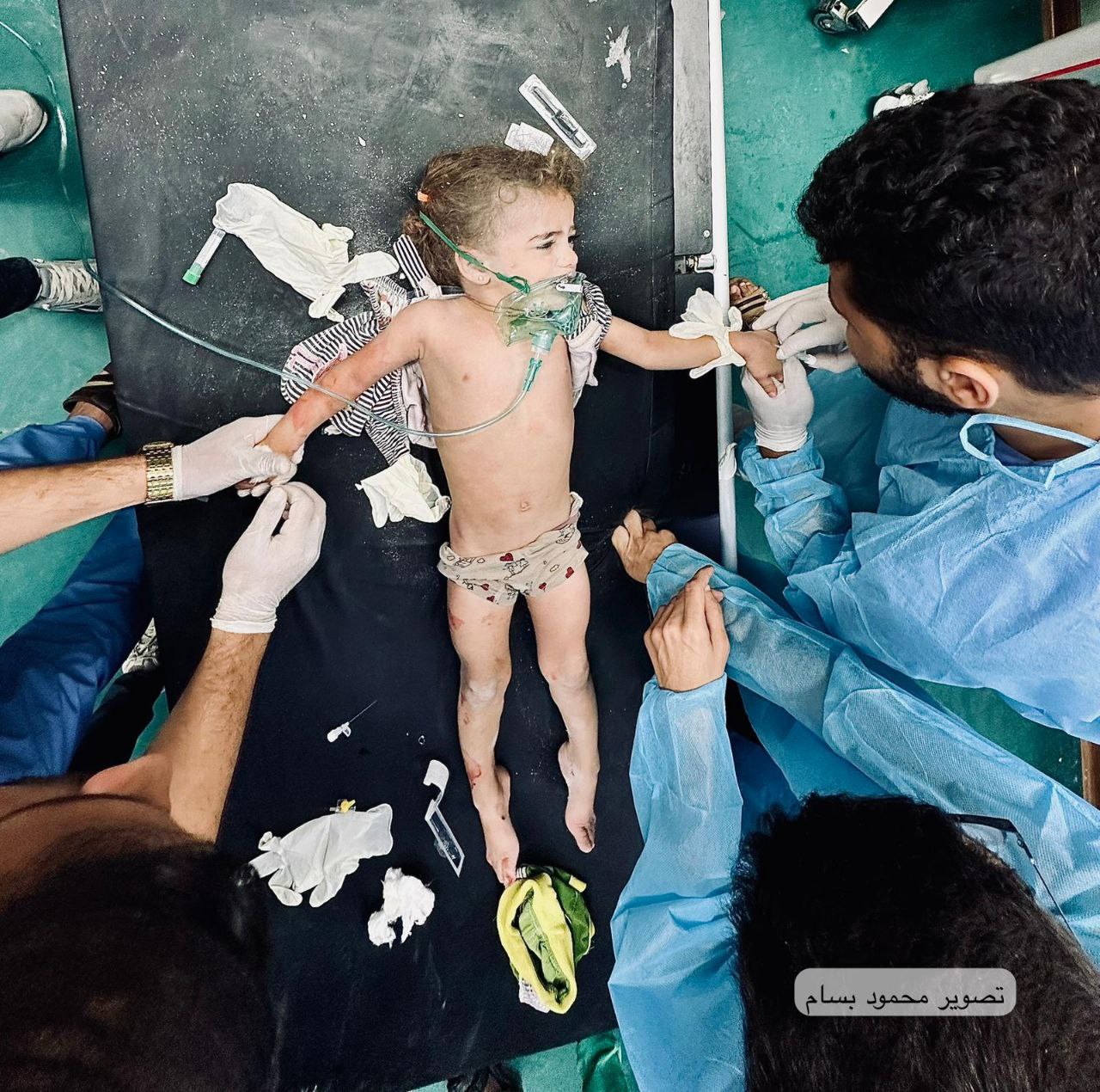 Palestinian Girl Injured in Israeli Airstrike on Rafah