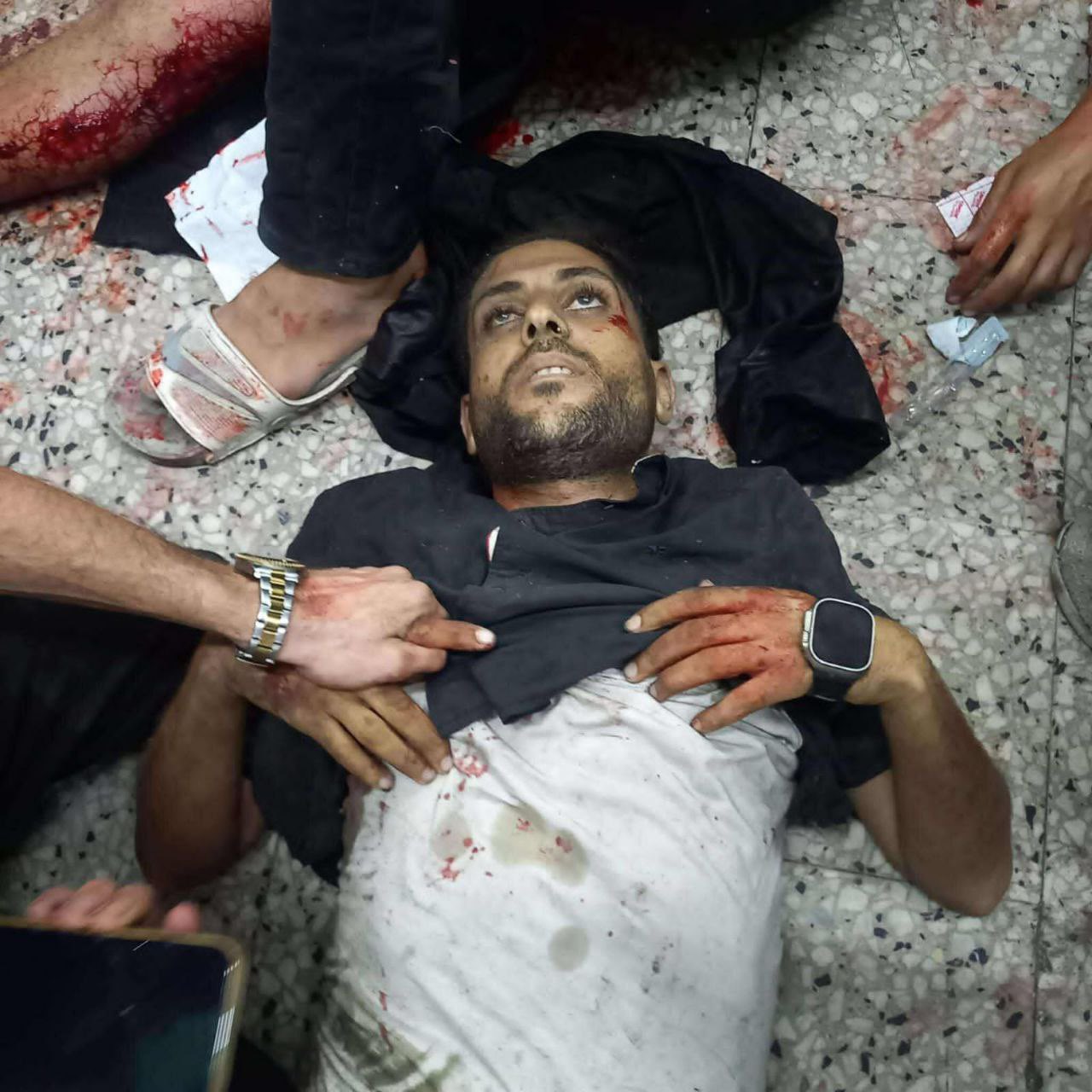 Journalist Mohammed Qurqe Among Victims of Incident