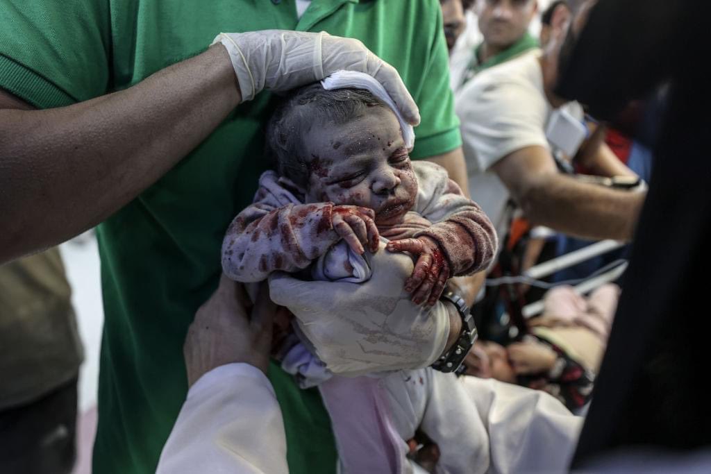 Over 100 Palestinians Killed in Gaza Strip Airstrikes