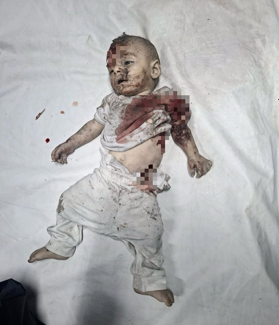 Children of Gaza: humanitarian crisis and impact on vulnerable populations