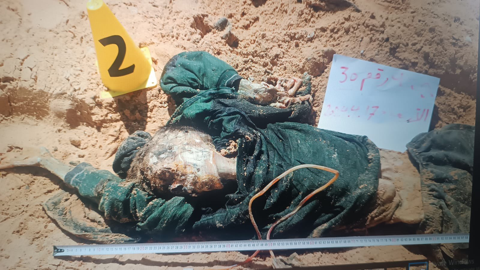Civil Defence Reports 73 Bodies Retrieved from Nasser Hospital