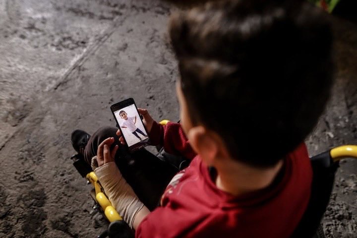 12-year-old boy loses leg in Israeli strike