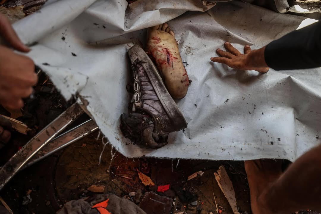 Palestinian Casualties from Israeli Airstrikes in Gaza Strip
