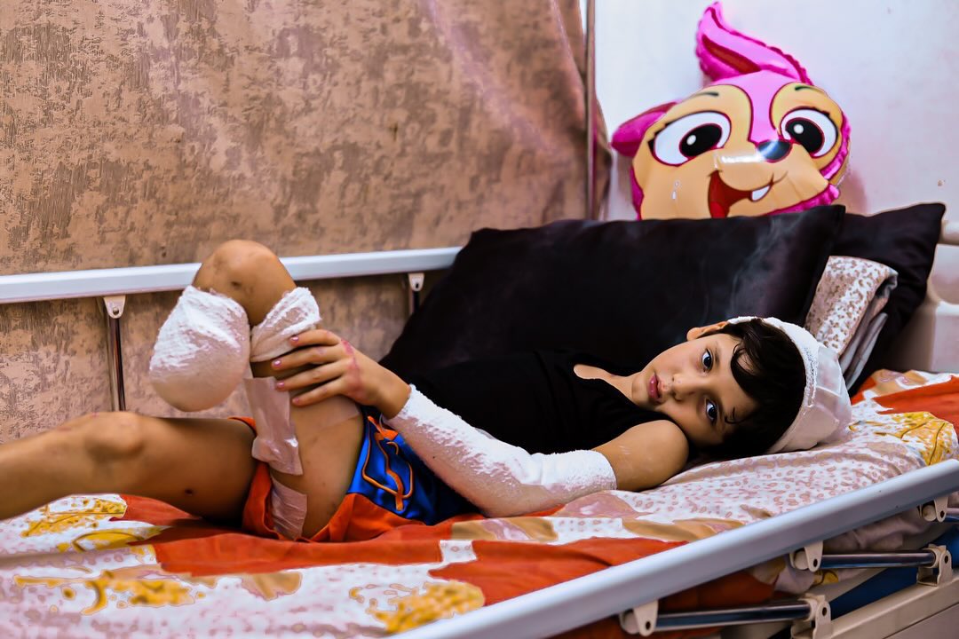 Child casualty account from Gaza conflict