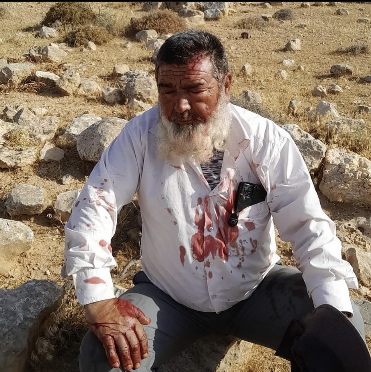 Israeli settlers attack Palestinian shepherds in Masafer Yatta