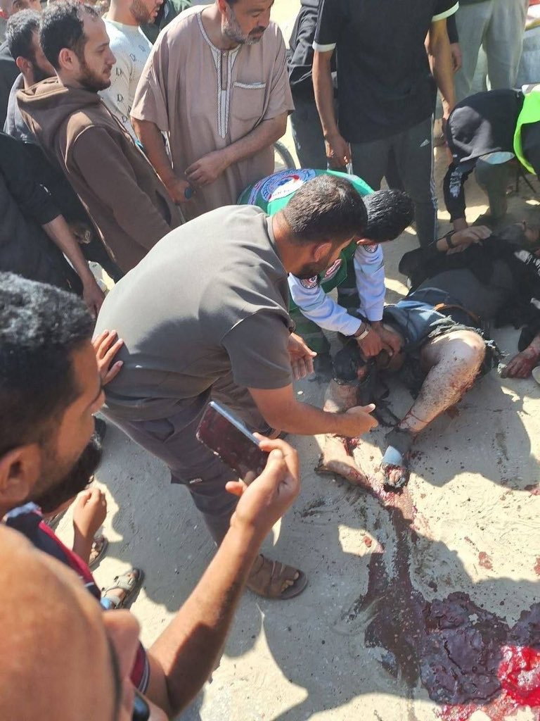 Israeli forces kill 7, wound 8 in Gaza