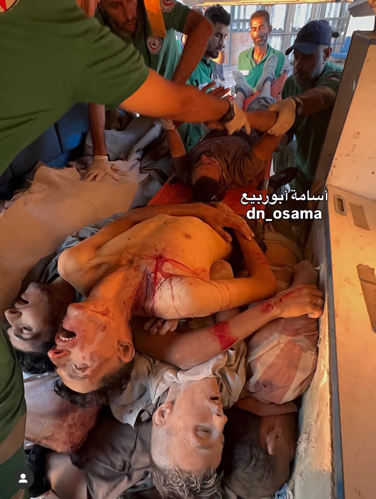Israeli military operation in Gaza results in 100 Palestinian casualties