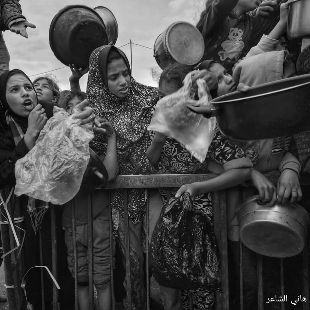 Children in Gaza face severe hunger and hardship