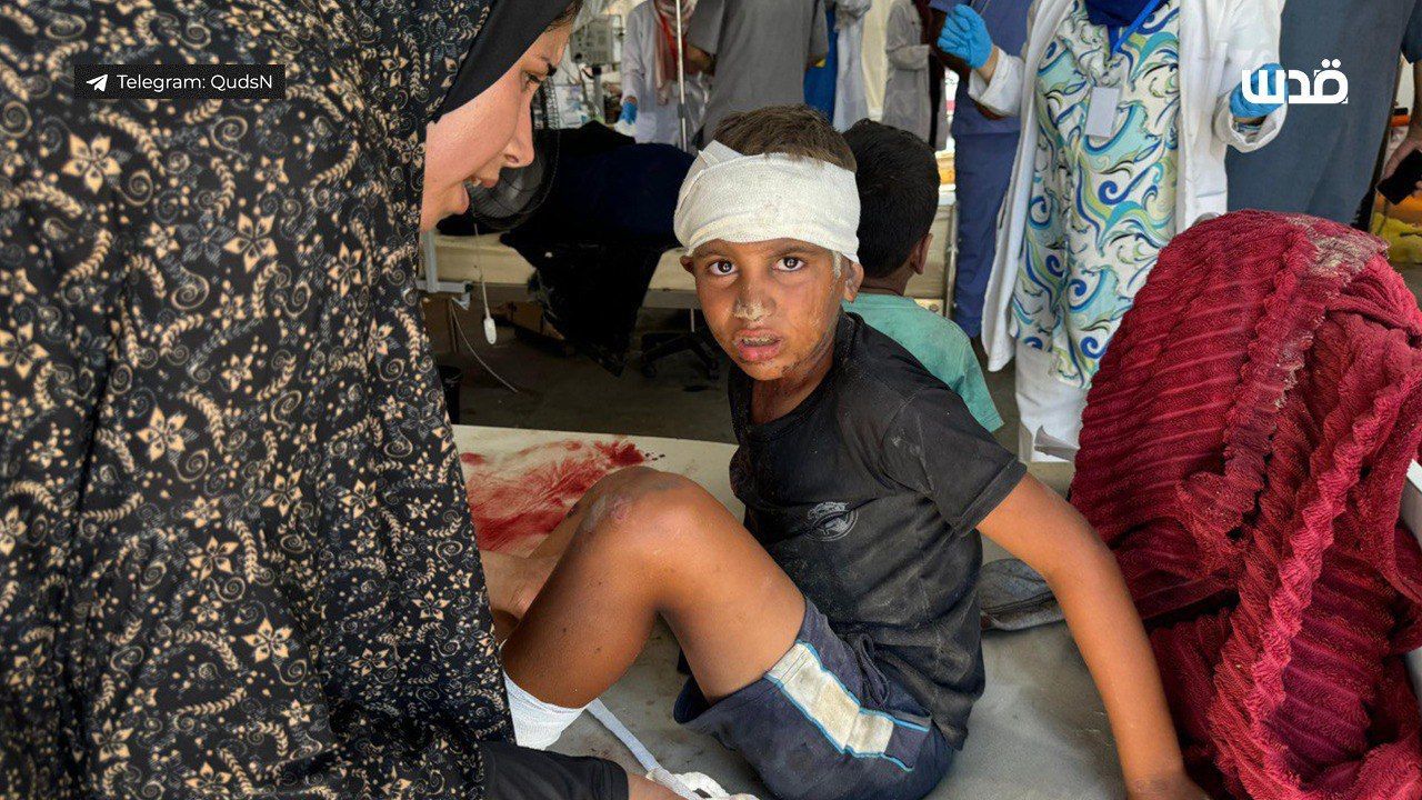 Israeli massacre in Mawasi displaces Palestinians, children injured