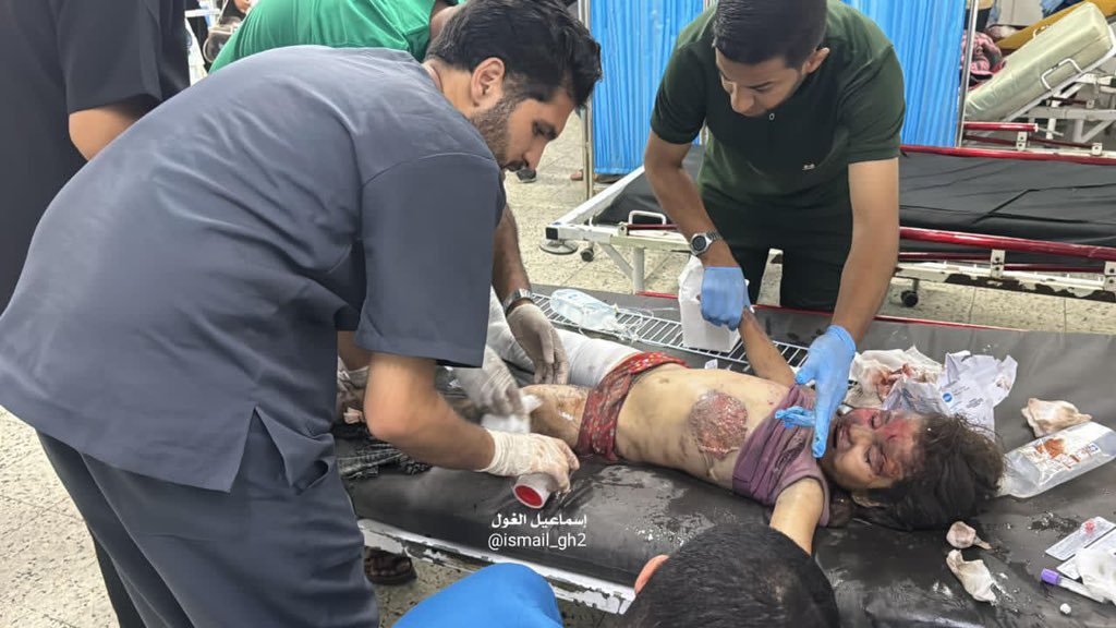 Medical Crisis in Gaza: Hospital Treatment Conditions