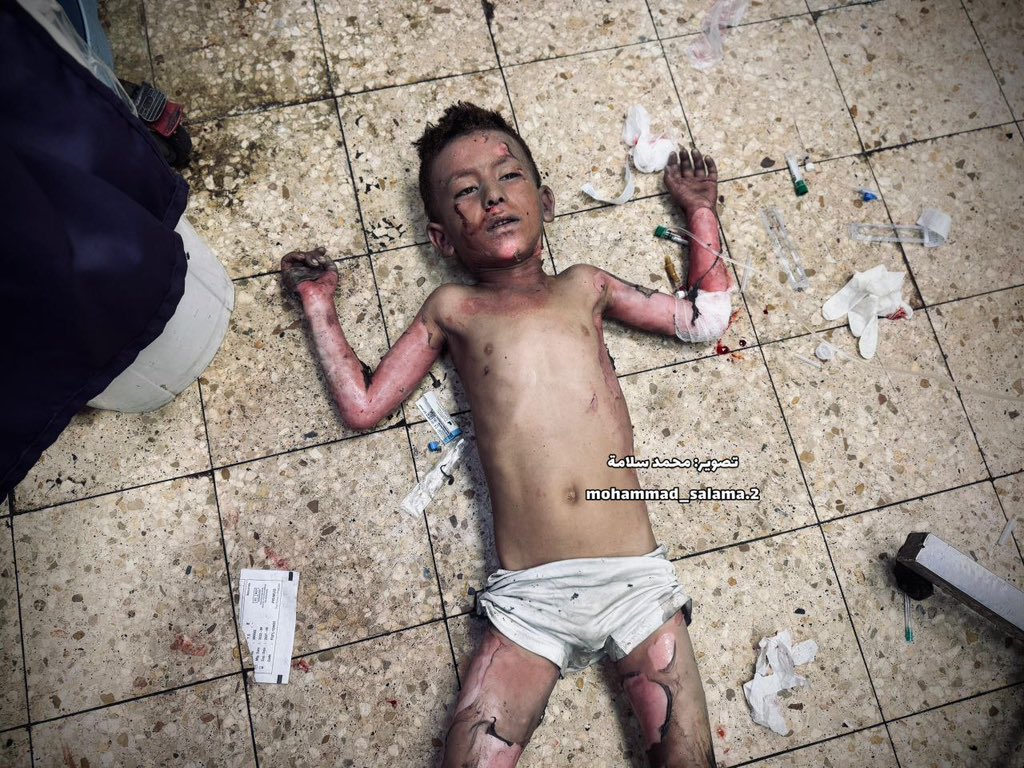 Israeli bombing kills family in Al Mawasi, Khan Younis