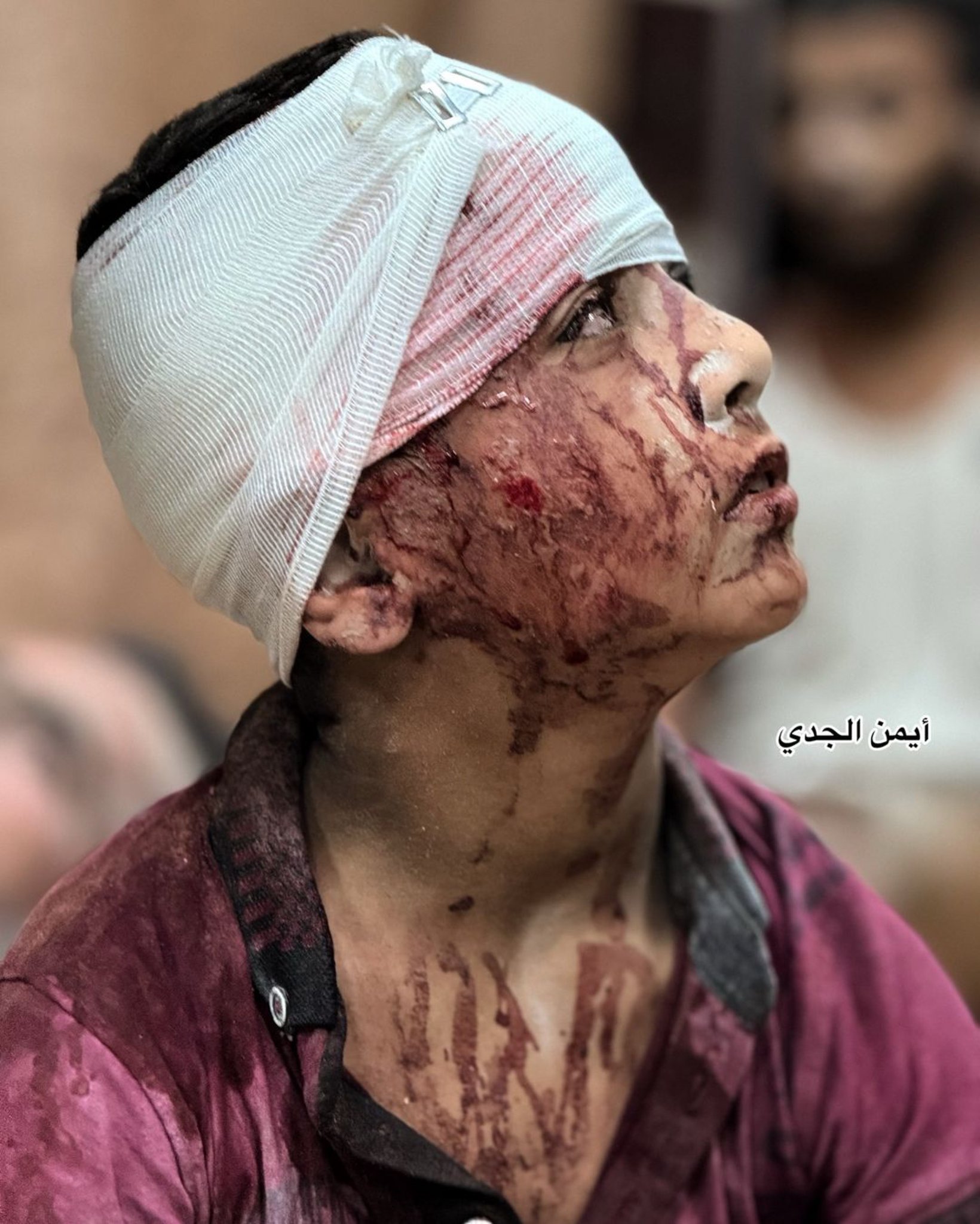 Exhaustion from World’s Indifference to Palestinian Suffering