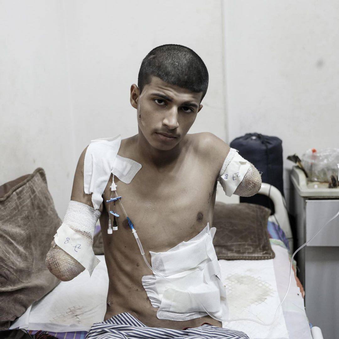 Israeli aggression on Gaza Strip continues 328th day