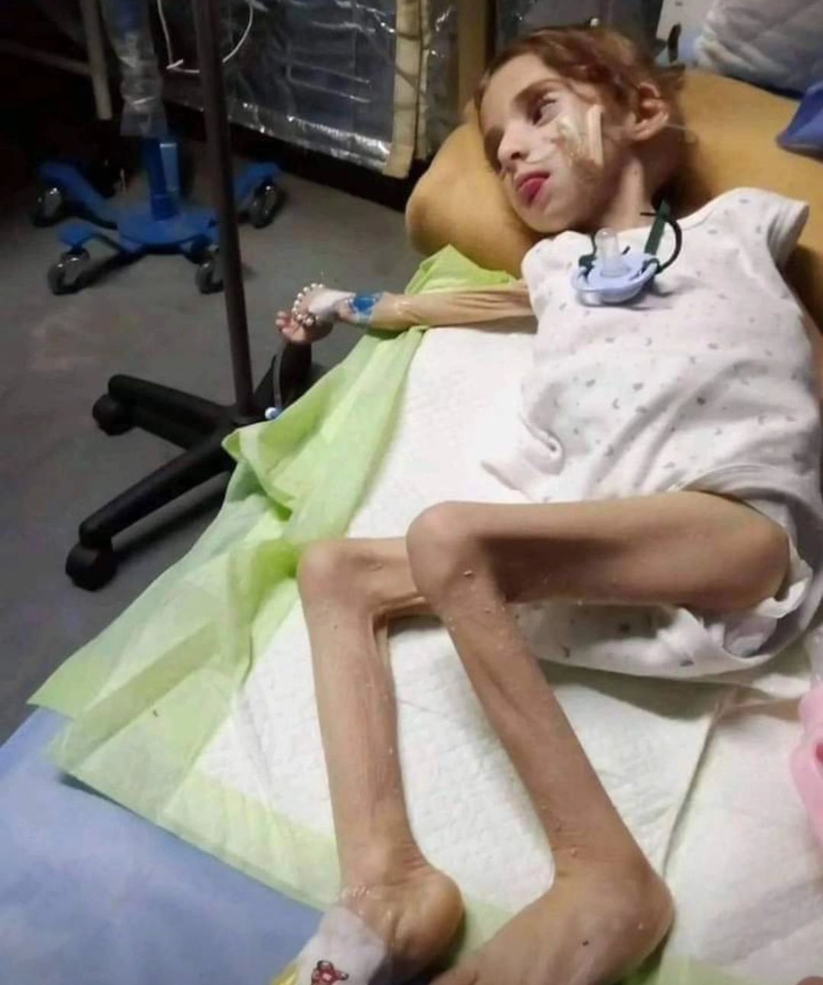 Gaza Starvation: Israel’s Military Strategy Questioned