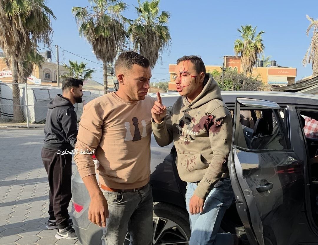 Injuries arrive at Al-Aqsa Hospital from ongoing Israeli strikes in Gaza