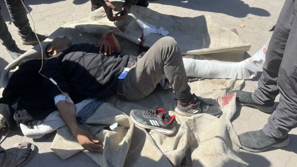 Israeli military operations in Gaza: Day 170 casualty report