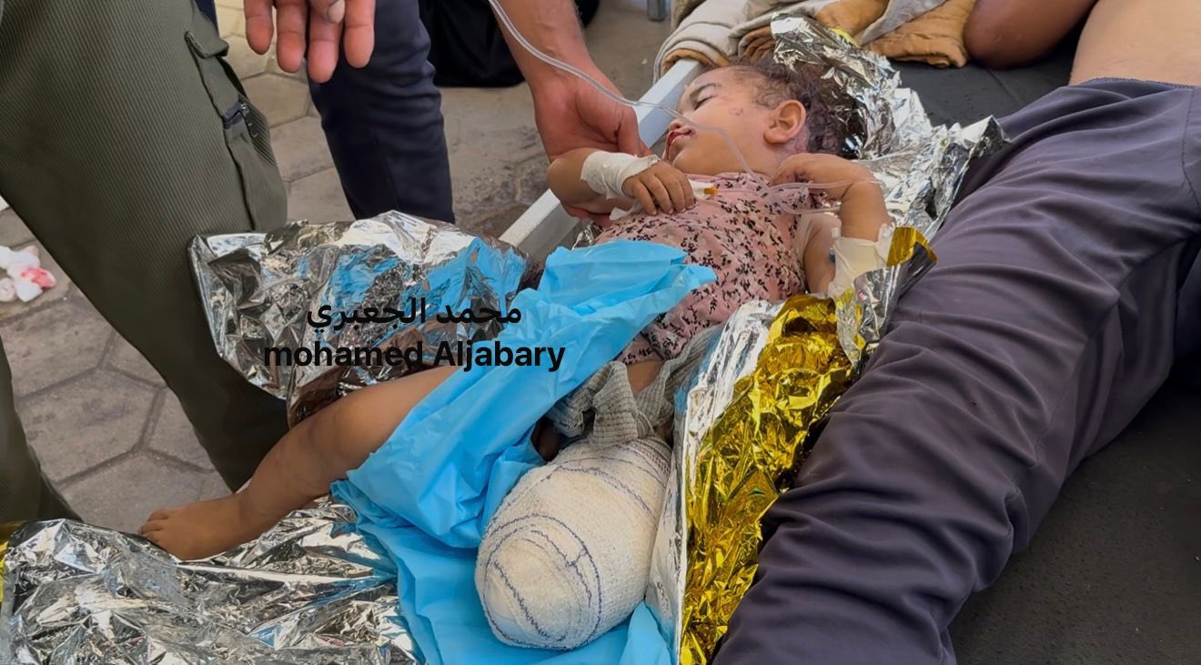 Baby Zeineh Abu Wardeh loses leg in Israeli bombing of Halima School