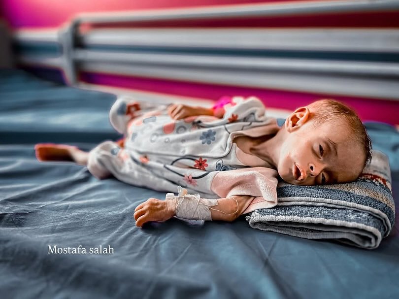 Children in Gaza Face Starvation Crisis Amid Humanitarian Emergency
